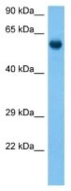 Neuronal Pentraxin R/NPTXR Rabbit anti-Mouse, Polyclonal, Novus Biologicals:Antibodies:Primary